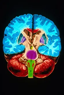 Human Brain Anatomy Drucke: Brain, Coronal Section