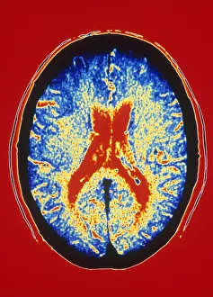 Human Brain Anatomy Drucke: Brain, CT Scan