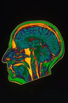 Brain MRI Scan Drucke: Brain MRI