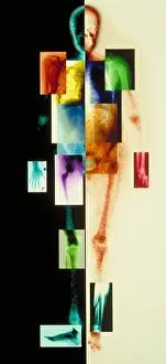 Medical Imaging Technology Drucke: Composite of body