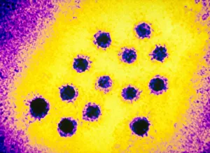 TEM Micrograph Drucke: Hepatitis A Virus (TEM)