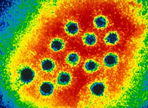 Microscopic Images Drucke: Hepatitis A Virus (TEM)