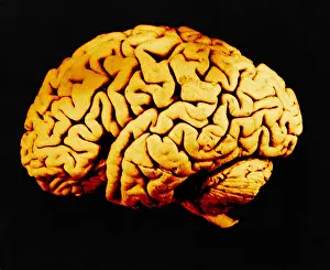 Human Body Systems Drucke: Human Brain