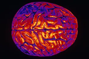 Human Brain Anatomy Drucke: Human Brain