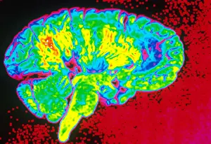 Human Brain Anatomy Drucke: Human Brain