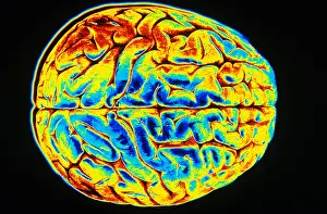 Nervous System Diagrams Drucke: Human Brain