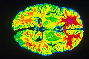 Magnetic Resonance Imaging Drucke: Human Brain