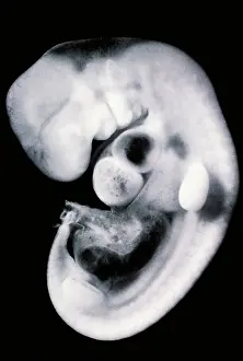 Scanning Electron Microscope Images Drucke: Human embryo