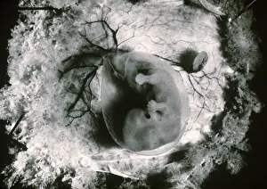Human Embryo Development Drucke: Human Embryo