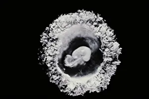 Scanning Electron Microscopy Drucke: Human embryo
