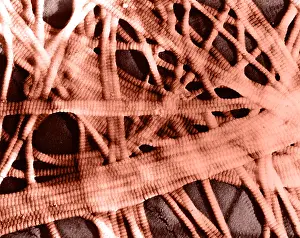 TEM Micrograph Drucke: Integumentary System, Subcutaneous Tissue, TEM