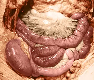 Human Anatomy Drucke: Intestines