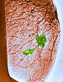 Medical Imaging Techniques Drucke: Mammogram