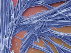 Scanning Electron Microscopy Photos Drucke: Caffeine Crystals, under a microscope (SEM)