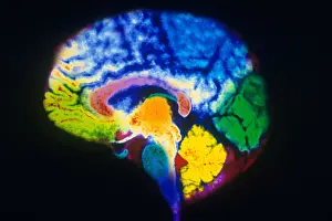 Normal Brain Anatomy Drucke: MRI of Brain