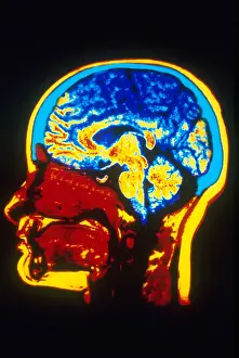 Medical Imaging Techniques Drucke: MRI of Head