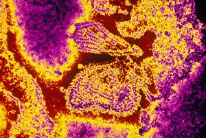 Medical Microbiology Images Drucke: Mumps Virus (TEM)