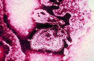 Mumps-Virus (TEM)