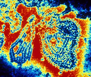 Medical Microbiology Images Drucke: Mumps Virus (TEM)