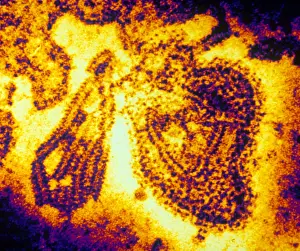 Medical Microbiology Drucke: Mumps Virus (TEM)