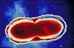 Gram Positive Bacteria Drucke: Pseudomonas cepacea