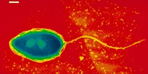 Gram Positive Bacteria Drucke: Pseudomonas cepacea