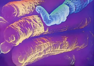 Scanning Electron Microscope SEM Drucke: Rods and Cones, under a microscope (SEM)