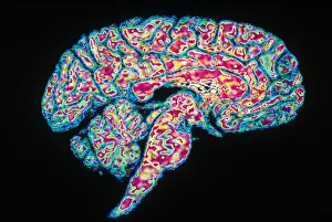 Human Nervous System Drucke: Sagittal Section of Brain