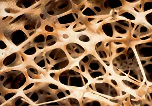 Human Bone Structure Drucke: Shin Connecting Bones SEM