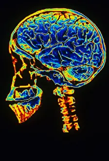 Nervous System Diagrams Drucke: Skull With Brain