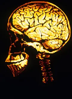 Human Brain Illustration Drucke: Skull With Brain