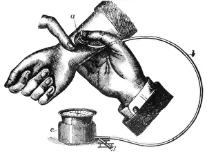Blood Pressure Measurement Drucke: Sphygmomanometer, 1883