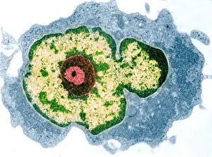 TEM Micrograph Drucke: Spleen cell