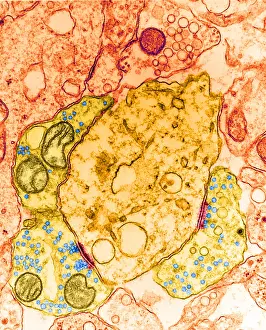 Transmission Electron Microscopy (TEM) Drucke: Synapse, TEM