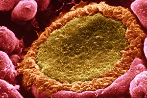 Electron Microscopy Images Drucke: Taste bud