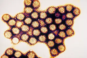 TEM von Rotavirus