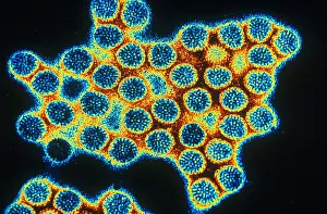Electron Microscopy Images Drucke: TEM of Rotavirus