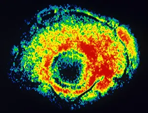 Electron Microscopy Images Drucke: TEM of Varicella