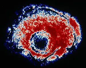 Electron Microscopy Images Drucke: TEM of Varicella